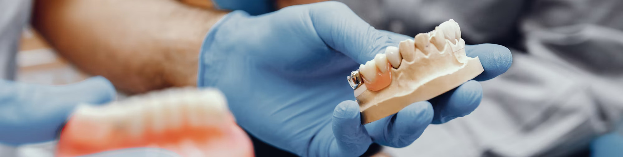Wizualizacja implantu zębowego